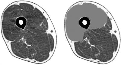 Relationship between quadriceps muscle computed tomography measurement and motor function, muscle mass, and sarcopenia diagnosis